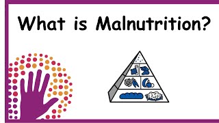 What is Malnutrition [upl. by Nevah]