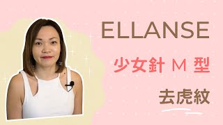 【Ellanse M型效果】Lulu親試去虎紋針！Ellanse少女針即時感覺、去虎紋評價 [upl. by Saleme]