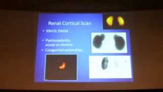 RENAL CORTICAL SCINTIGRAPHY by DRKAVITHA Prof and HOD  Nuclear medicine KREST 2015 22 [upl. by Lilhak]