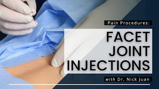 Facet Joint Injections What You Need To Know [upl. by Emalia]