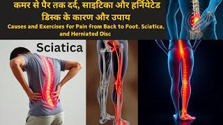 Causes and Exercises for Pain from Back to Foot Sciatica and Herniated DiscLumber Rediculopathy [upl. by Roselani]