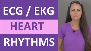 EKG Rhythms  ECG Heart Rhythms Explained  Comprehensive NCLEX Review [upl. by Adnwahsor660]