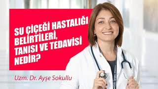 Su çiçeği hastalığı belirtileri tanısı ve tedavisi nedir [upl. by Ellitnahc]