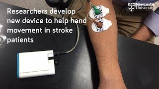 Device to help stroke patients recover hand movement [upl. by Ahsitra]