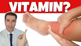 No1 vitamin for removing leg and foot SWELLING [upl. by Annuahsal]