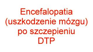 Encefalopatia po szczepieniu DTP [upl. by Nothgierc]