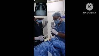 Esophagoscopy procedure to remove foreign bodyesophagoscopyRigid esophagoscopy [upl. by Llennoj]