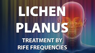 Lichen Planus LP  RIFE Frequencies Treatment  Energy amp Quantum Medicine with Bioresonance [upl. by Verile]