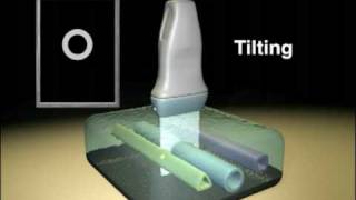 Ultrasound Transducer Manipulation [upl. by Amliw]