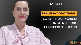 Descubra como tratar gastrite enantemantosa de antro moderada com duodenite erosiva [upl. by Lasorella209]