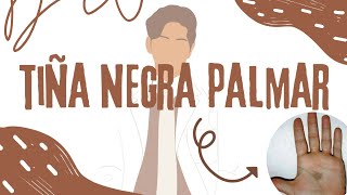 TIÑA NEGRA PALMARSIGNOS Y SINTOMASDIAGNÓSTICOTRATAMIENTO🤩 [upl. by Oine]