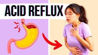 How to Get Rid of Acid Reflux  Top 5 Best Working Home Remedies [upl. by Klotz336]