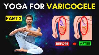 Varicocele Exercises Part 2 At Home  Yoga for Varicocele varicocele [upl. by Savinirs]