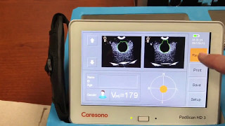 Caresono PadScan HD3 Bladder Scanner Tutorial [upl. by Ondine231]