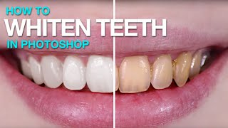 How to Whiten Teeth in Photoshop [upl. by Kalman]