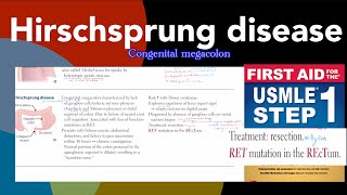 Hirschsprung disease in HindiUrdu by first aid for USMLE step 1 [upl. by Frodina856]