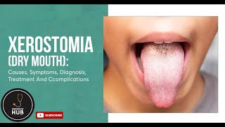 Xerostomia Causes Symptoms and Treatments  Knowhow Hub [upl. by Glaser]