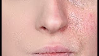 HOW TO HIDE ENLARGED PORES amp MAKE YOUR PORES DISAPPEAR [upl. by Mercado]