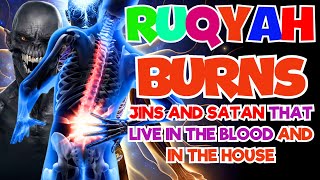 Ruqyah verses that burn jinns and Satan in the body and those that nest in the house [upl. by Nilrev]