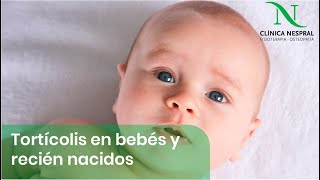 Tortícolis en bebes y niños recién nacidos 👶🏻 Fisioterapia Pediátrica Gijón Asturias [upl. by Naujtna24]