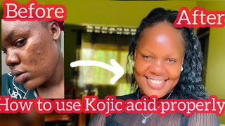 HOW TO USE KOJIC ACID SOAP WATCH THIS BEFORE USING KOJIC ACID [upl. by Ahsinauj367]