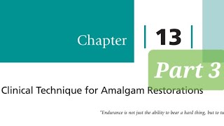 Clinical Technique for Amalgam Restorations part 3 Class 2 Amalgam Restorations Matrix and Wedges [upl. by Madelyn728]