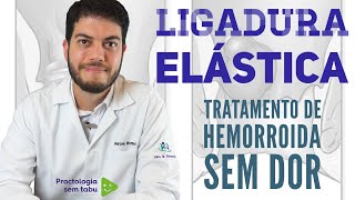 Ligadura elástica de hemorroida você conhece esse tratamento Tratamento para hemorroida interna [upl. by Antons]