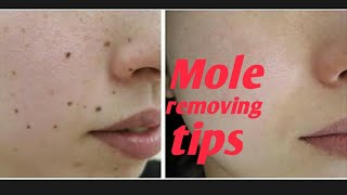 How to remove mole on face and til removing home remedies how to brown til and mole [upl. by Houghton247]