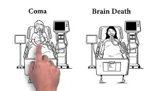 How is Brain Death Different than Coma [upl. by Pompea]