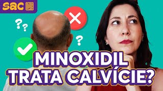 Minoxidil funciona mesmo [upl. by Yhtorod]