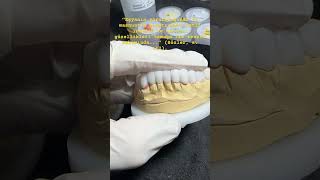 dentist dental orthodontist dentalclinic diş veneers reels dişteknisyeni emaxveneers [upl. by Charry]