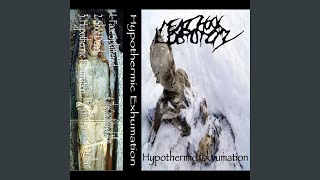 Hypothermic Exhumation [upl. by Erminie]