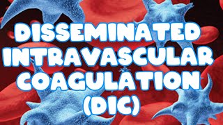 Disseminated intravascular coagulation DIC HEMATOLOGY [upl. by Htez]