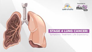 Stage 4 Lung Cancer Symptoms Treatment Life Expectancy  Episode 22 [upl. by Nereus260]