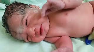 Vernix caseosa healthy baby newborn baby ShobhaNursingguide plz like plzsubscribemychannel [upl. by Hally]