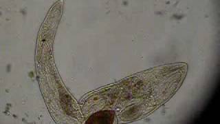 Gyratrix hermaphroditus Fam Polycystididae F Platyhelminthes 1 [upl. by Mella]