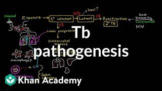 TB pathogenesis  Infectious diseases  NCLEXRN  Khan Academy [upl. by Itirahc361]