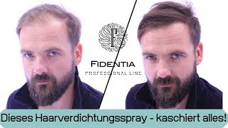 Wieder volles Haar ohne Haarsystem  Transformation mit Mane Haarauffüller Spray [upl. by Rhines]