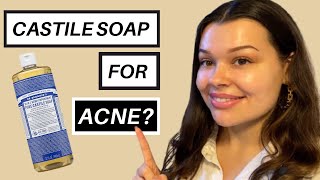 Castile soap for the face why its a really bad idea [upl. by Mahgem]