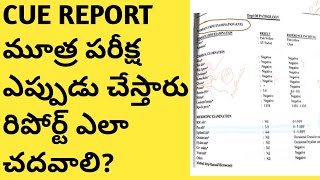 urine test in teluguHow to read cue report in teluguurine analysis in telugupus cells in urine [upl. by Atinit]