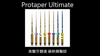 Protaper Ultimate  A Brief Review [upl. by Galitea429]