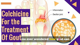 COLCHICINE Tablets For The GOUT Treatment [upl. by Ainat435]