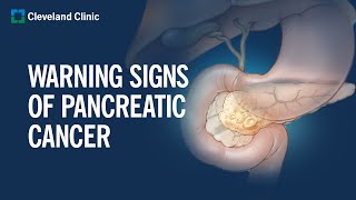 6 Warning Signs of Pancreatic Cancer [upl. by Watkins611]