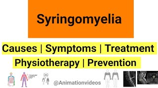 What is Syringomyelia  Pathophysiology  Symptoms  Physiotherapy Treatment [upl. by Mitchel756]