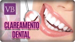 Mitos e Verdades do Clareamento Dental  Você Bonita 250117 [upl. by Nnyleahs]