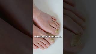 White Spots on Nails Discover What Your Nails Say About Your Health [upl. by Sankaran]