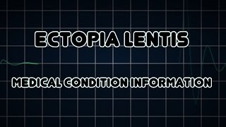 Ectopia lentis Medical Condition [upl. by Wagshul]