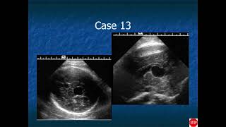 RADIOLOGY EXAM CASES [upl. by Ydneh]