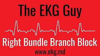 Right Bundle Branch Block complete on EKG  ECG l The EKG Guy  wwwekgmd [upl. by Kam]