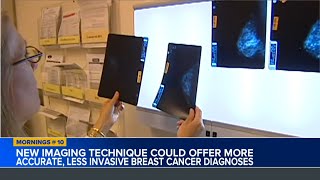 Researchers use new imaging technique for breast cancer screening [upl. by Siusan916]